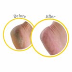 OKEFFEY_Healthy_Feet_Exfiolating_Tube