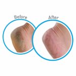 OKEFFEY_Healthy_Feet_Foot_Cream_Tube