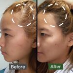 SOME_BY_MI_Cica_Peptide_Anti_Hair_Loss_Derma_Scalp_3Bundle