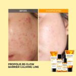 SOME_BY_MI_Propolis_B5_Glow_Barrier_Calming_Starter_Kit