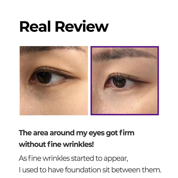 SOME_BY_MI_Retinol_Intense_Advanced_Triple_Action_Eye_Cream_Review