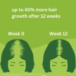Priorin_Hair_Growth_Stimulation_Treatment