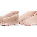 EUCERIN_Urea_Repair_Plus_10%_Urea_Foot_Cream