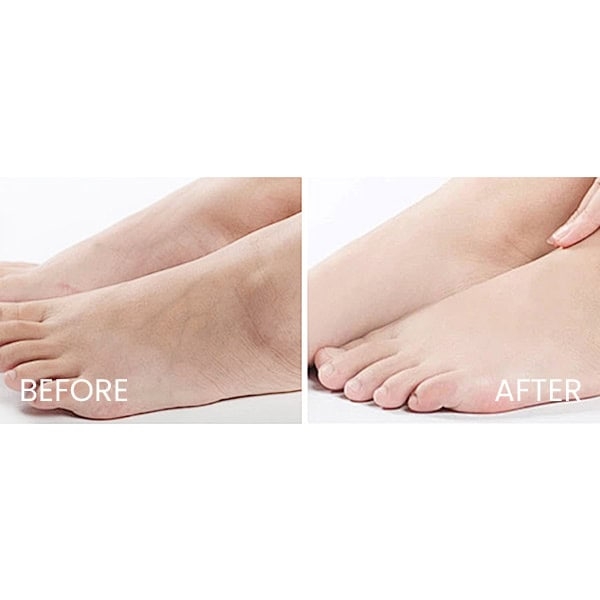 EUCERIN_Urea_Repair_Plus_10%_Urea_Foot_Cream_Usage